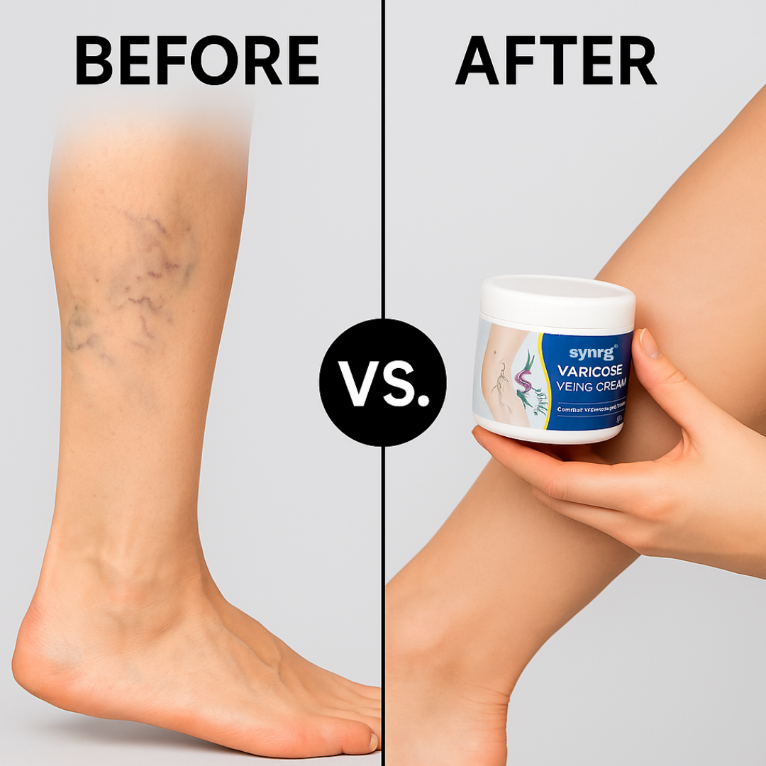 Varicose Veins Cream™